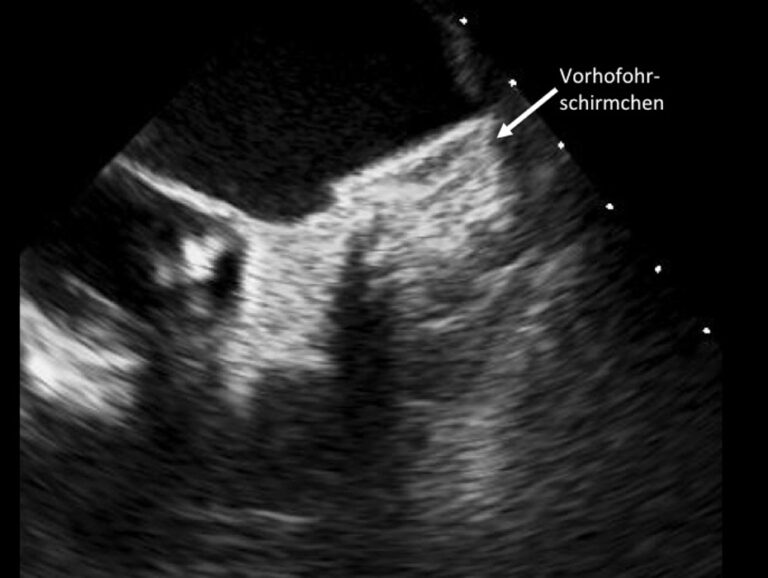 Was macht ein Kardiologe? Aufgaben & Diagnostik erklärt