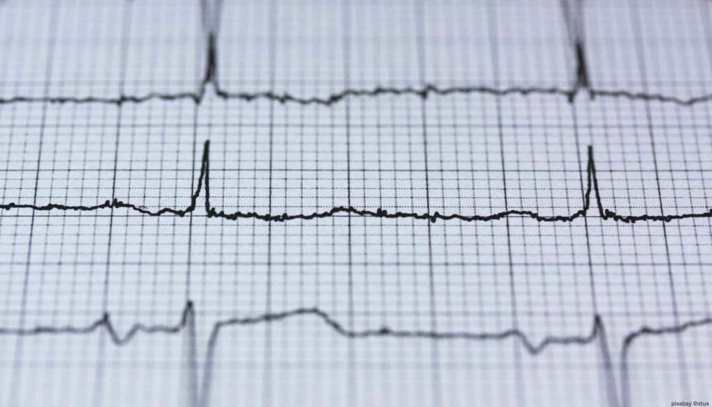 Ergebnis eines EKGs mit dem Ausschlag des Herzens