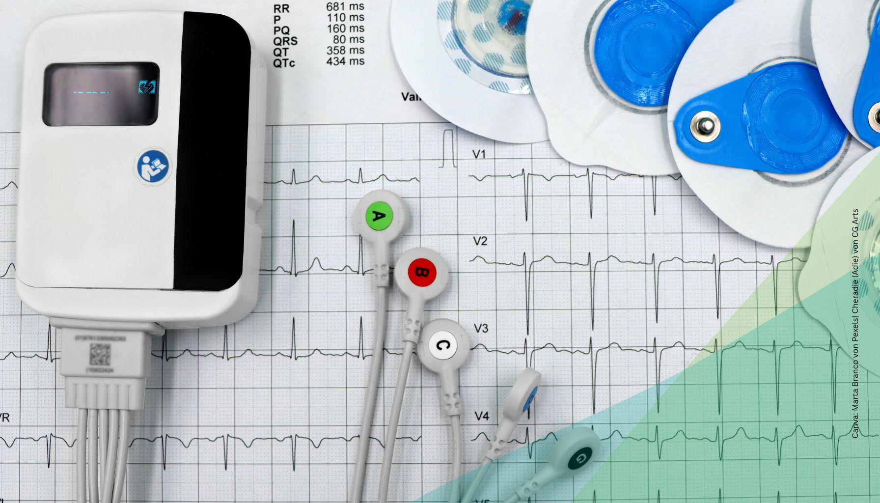 EKG mit Anschlüssen und Auswertung